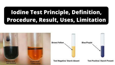 Iodine Test: Definition, Objective, Principle, Procedure, Results.